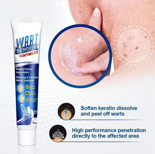 Instant Wart Remover (Buy 1 Get 1 Free)